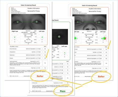 Eye test results .
